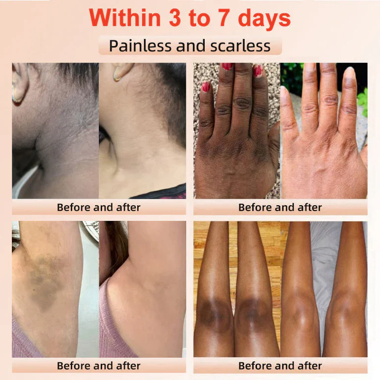 Elarae™ Exfoliating Gel