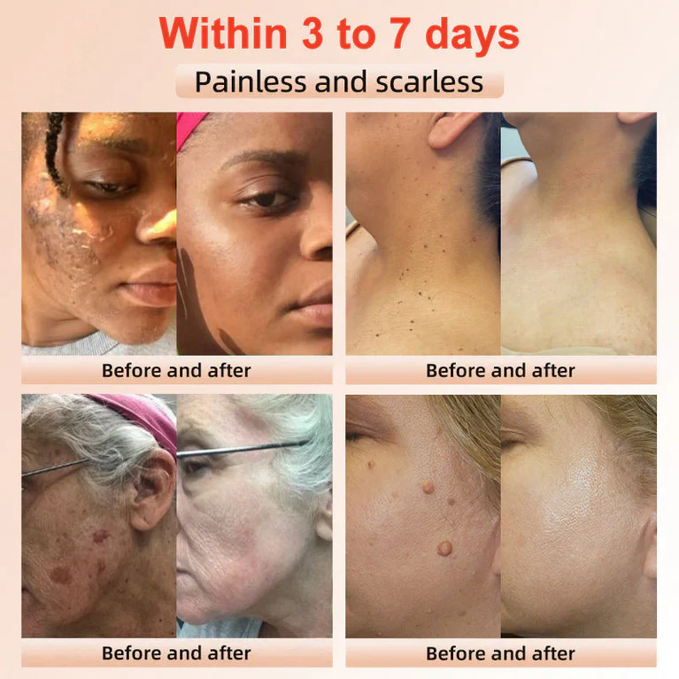 Elarae™ Exfoliating Gel