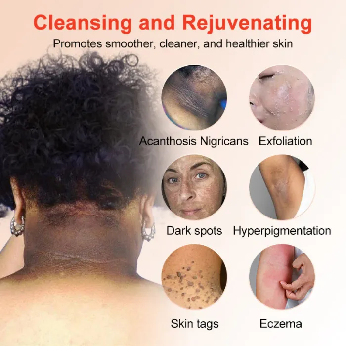 Elarae™ Exfoliating Gel