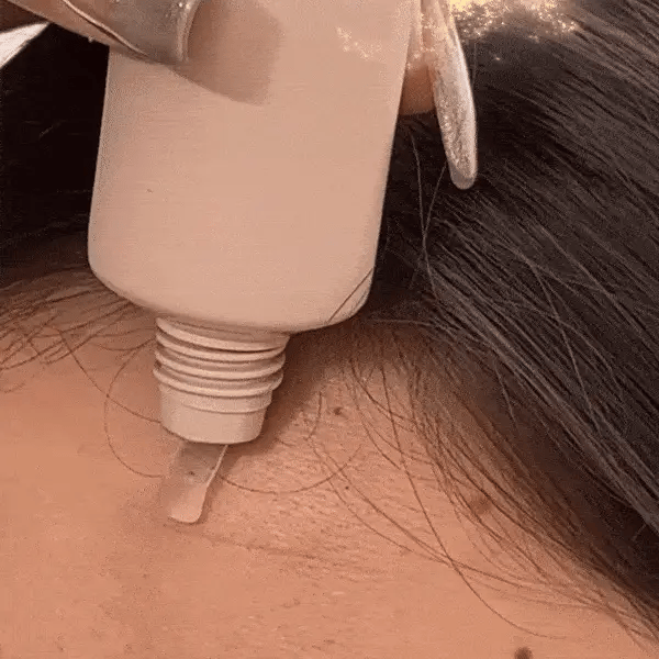 Elarae™ Exfoliating Gel